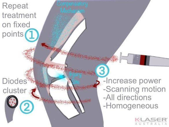 Step 2-Laser therapy scanning motion-800