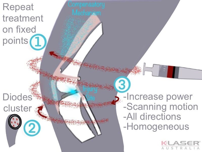 Clinical Limitations Of Laser Therapy KLaser Resources