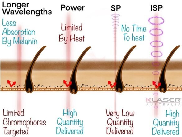 Step 2 - Melanin Pigment 2