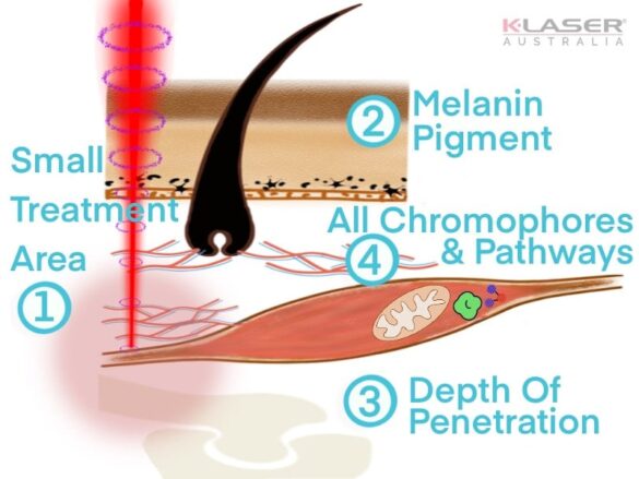 Step2-Laser Therapy Limitations-800